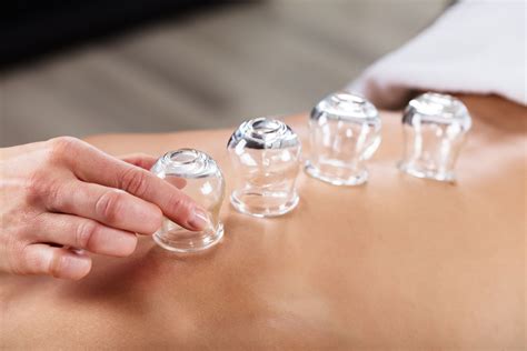Cupping Massage Therapies In Grantham